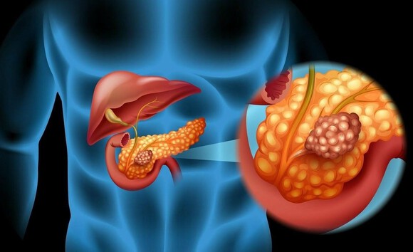 Enzyme tiêu hóa – bí quyết cho hệ tiêu hóa khỏe mạnh 