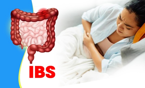 Đau do hội chứng ruột kích thích thường xuất hiện ở đâu? 