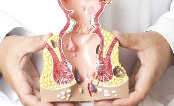 Đau hậu môn khi đi ngoài có nguy hiểm? Khi nào cần khám bác sĩ? 