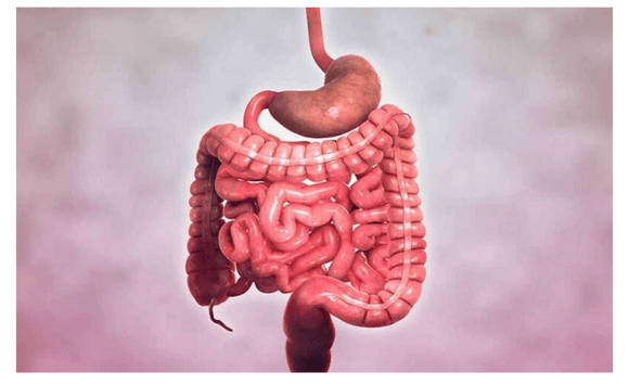 Phân biệt bệnh Crohn và hội chứng ruột kích thích (IBS) 