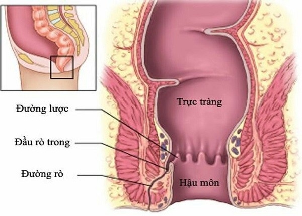 FTT_Đau hậu môn khi đi ngoài có nguy hiểm không