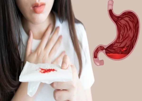 FTT_Phân đen có nguy hiểm không?