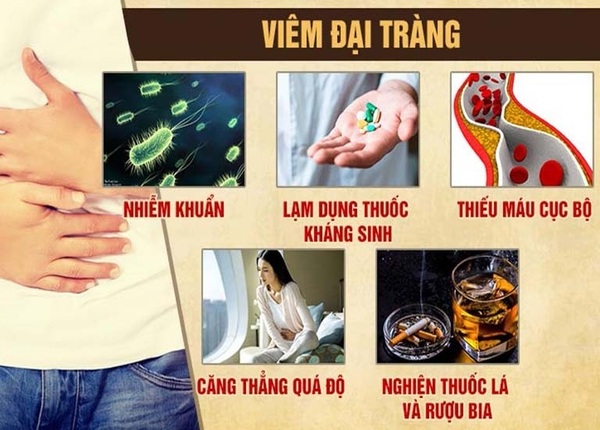FTT_Biến chứng viêm đại tràng