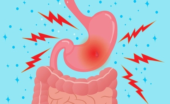 Nhiệt miệng dai dẳng? Đừng quên kiểm tra đường ruột của bạn! 