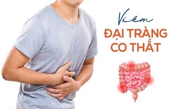 Viêm đại tràng co thắt là gì? Nguyên nhân và cách điều trị hiệu quả