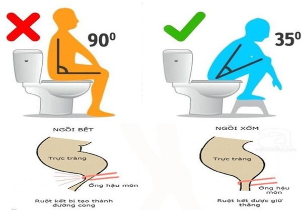 FTT_Viêm trực tràng ngày càng trẻ hóa