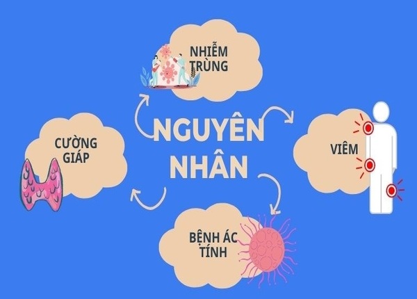 FTT_Sốt không rõ nguyên nhân