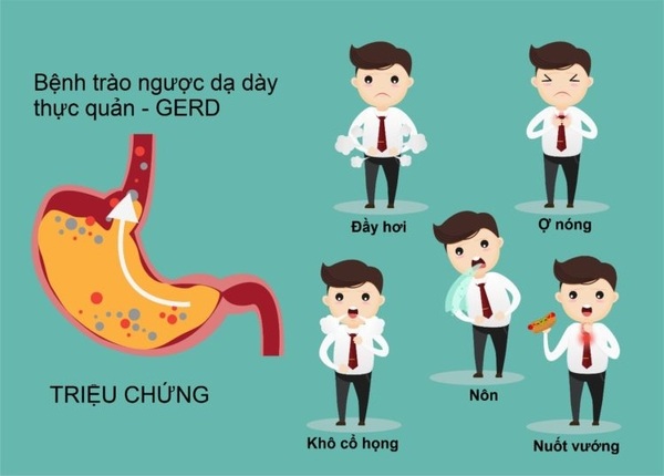 FTT_Trào ngược dạ dày thực quản là gì?