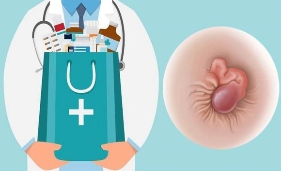 Tại sao bị sa trực tràng? Những nguyên nhân ít ai ngờ tới