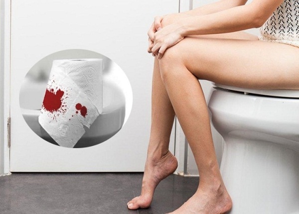 FTT_Đi ngoài ra máu do trĩ hay viêm đại tràng?