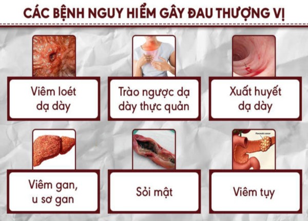 FTT_Lí do đau vùng thượng vị