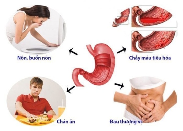 FTT_Đau dạ dày, viêm loét, trào ngược: Làm sao phân biệt?