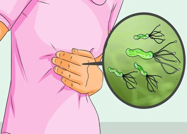FTT_Nhận biết sớm viêm hang vị dạ dày để tránh biến chứng nguy hiểm