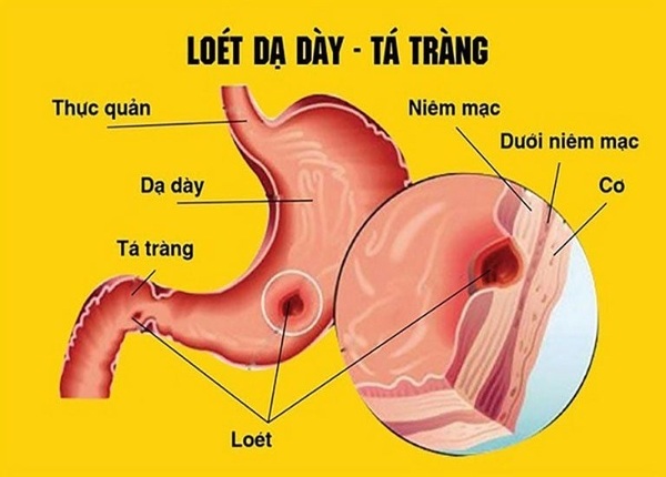 FTT_Tác động của muối với dạ dày trống rỗng vs khi đã no