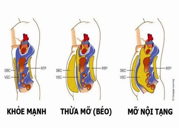 FTT_Mỡ nội tạng là gì? Hiểm họa sức khỏe ẩn sau vòng eo